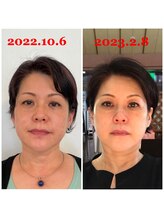 ハーボプラス(THE HEARBO plus)/あの日に戻りたくない