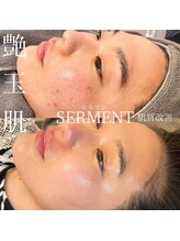 ベル(Belle)/セルマン艶玉肌