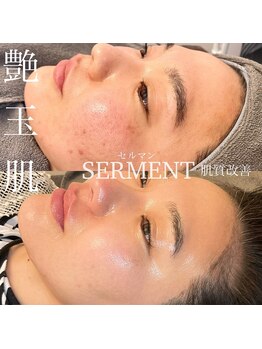 ベル(Belle)/セルマン艶玉肌