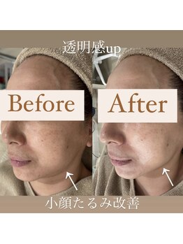 クリニカルホワイトケア 和泉府中店(クリニカルWHITEケア)/筋膜リリース表情筋ケア