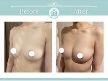 美人バスト 掛川店/【バストアップ/育乳静岡/掛川】