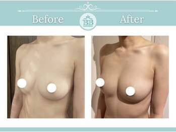 美人バスト 掛川店/【バストアップ/育乳静岡/掛川】