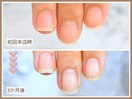 【自爪育成コース】