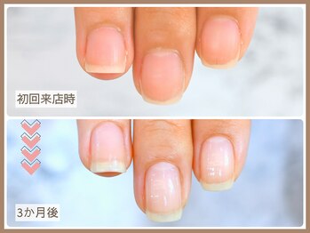 ルシェルアイ/【自爪育成コース】