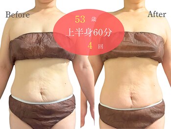 アルピナ(ALPINA)/ウルトランスフォーマー