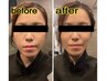 【姿勢美人整体】ソフトな刺激で姿勢改善美容系～45分¥8,800→¥4,400