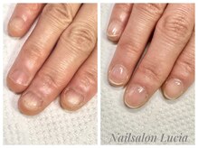 ネイルサロンルキア(Nail salon Lucia)の雰囲気（深爪育成・長さ出し無し（3ヶ月後）￥6600～）