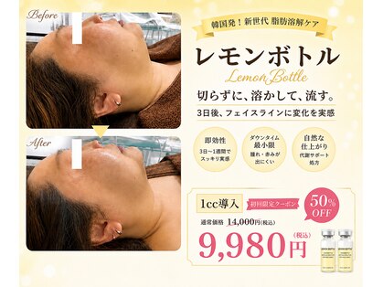 エステサロン アンジュール(Angelle)の写真