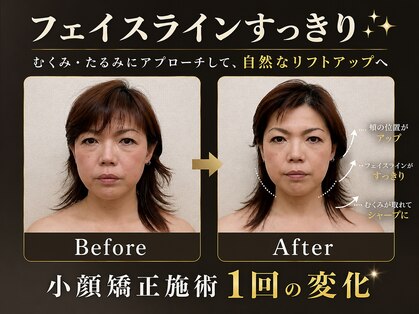 オリナサツキ(OlinaSatsuki)の写真