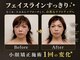 オリナサツキ(OlinaSatsuki)の写真