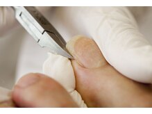 爪切り屋 足楽/足爪でお悩みの方は