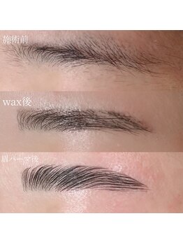 アルセ(arce)/美眉メニュー