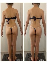 トワ 恵比寿(TOWA)/リリースカッターで姿勢改善！