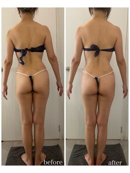 トワ 恵比寿(TOWA)/リリースカッターで姿勢改善！