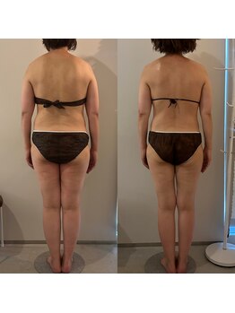 ラナ 京都西院店(Lana)/よもぎ蒸し＆リンパマッサージ