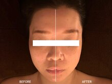頭蓋骨 小顔矯正サロン グレースフィオーレ 札幌店(gracefiore)/ビフォーアフター