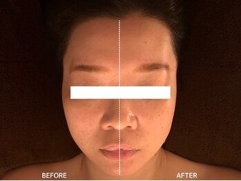 頭蓋骨 小顔矯正サロン グレースフィオーレ 札幌店(gracefiore)/ビフォーアフター