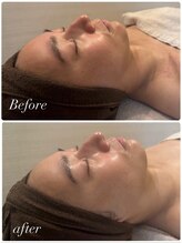 ブリス(BLiSS)/水素クレンジング＋美容液導入