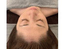 小顔/たるみ　お顔だけでなく背中、頭皮からもアプローチ/エステ