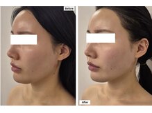 ルブランビューティー 麻布十番(Le blanc beauty)