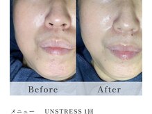 サロン ベルーチェ(SALON Belluce)/50代アンストレスでくすみ撃退♪