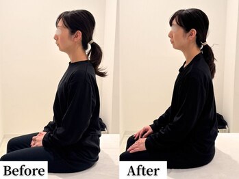 ソレア(Solea)/肩こり・猫背改善1回目