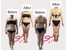 サンテボーテ(Sante Beaute)/身体のむくみ＆たるみ改善