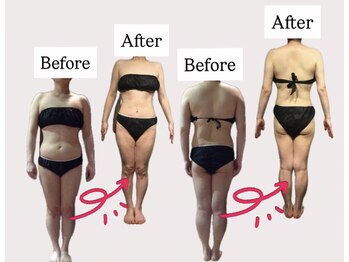 サンテボーテ(Sante Beaute)/身体のむくみ＆たるみ改善