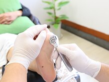 足のケア アンド 巻き爪 エムズ 白金通り店(M's)/たこのケア