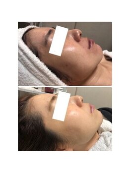 オアジスパ(Oasi Spa)/バイオセルショット65