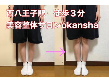 美容整体サロン オオカンシャ(okansha)/O脚Before→after