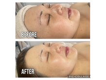 つるりの雰囲気（【リピート率90%超】シミ・くすみが気になる方はぜひご予約を！）