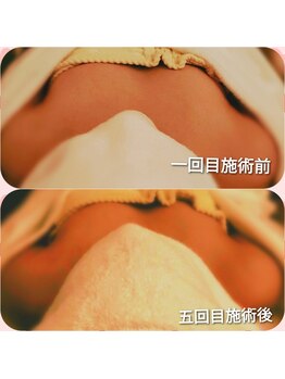 ほしにはろー/サイズケア