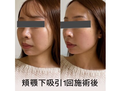 ミカド 銀座(mikado)の写真