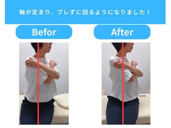 きくち整骨院/軸が定まり、ブレずに回るように