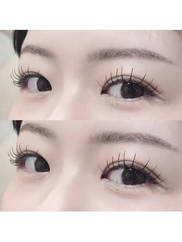 アネラ 表参道(Anela)/