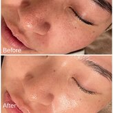 ラヴィアロマティックハーブ 高津 溝の口店(LaviAromaticHerb)