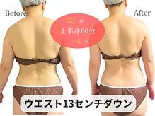 アルピナ(ALPINA)/ウルトランスフォーマー