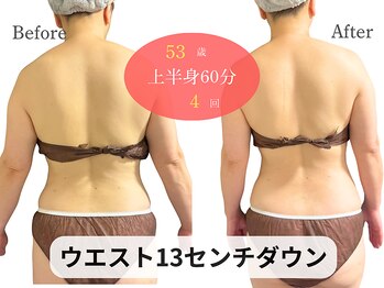 アルピナ(ALPINA)/ウルトランスフォーマー