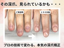 エルナ