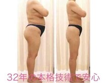 レディース ビホウ(BIHOU)