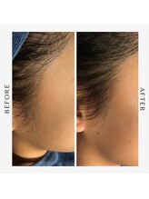 マーク(mark.)/フェイスシェービングで横顔美人