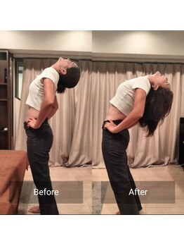 腰ラボ(腰Labo)/施術後の変化