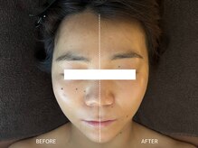 頭蓋骨 小顔矯正サロン グレースフィオーレ 札幌店(gracefiore)/ビフォーアフター
