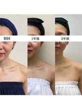 お顔の研究所/ビフォーアフター写真♪