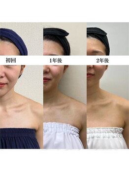 お顔の研究所/ビフォーアフター写真♪