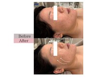 フロリール アザブジュウバン(FlorirAzabujuban)/フェイスライン専門ケア