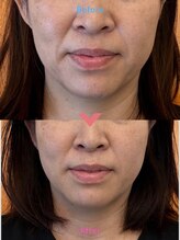 パーチェスガールズ 姪浜店(Pace-se Girls)/小顔矯正