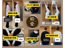 痛みや痺れはスジ調整の整体へ