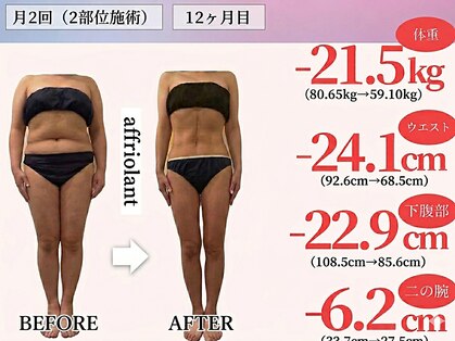 アフリオーラ(affriolant)の写真